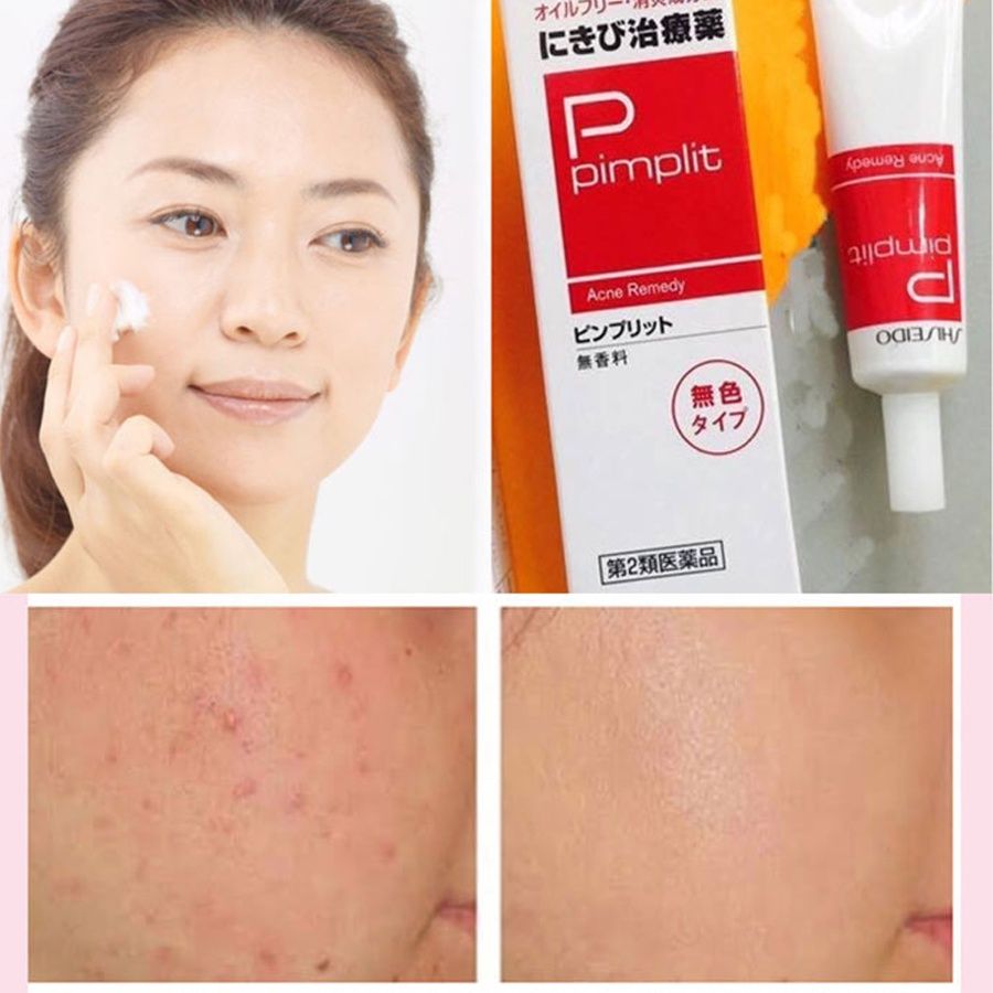 Kem Ngừa Mụn Shiseido Pimplit Nhật Bản Giảm Mụn Bọc, Mụn To 18 gram