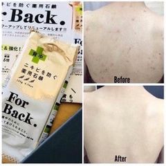 [Xà Bông Giảm Mụn Lưng] For Back Soap 135 Gr- Nhật Bản