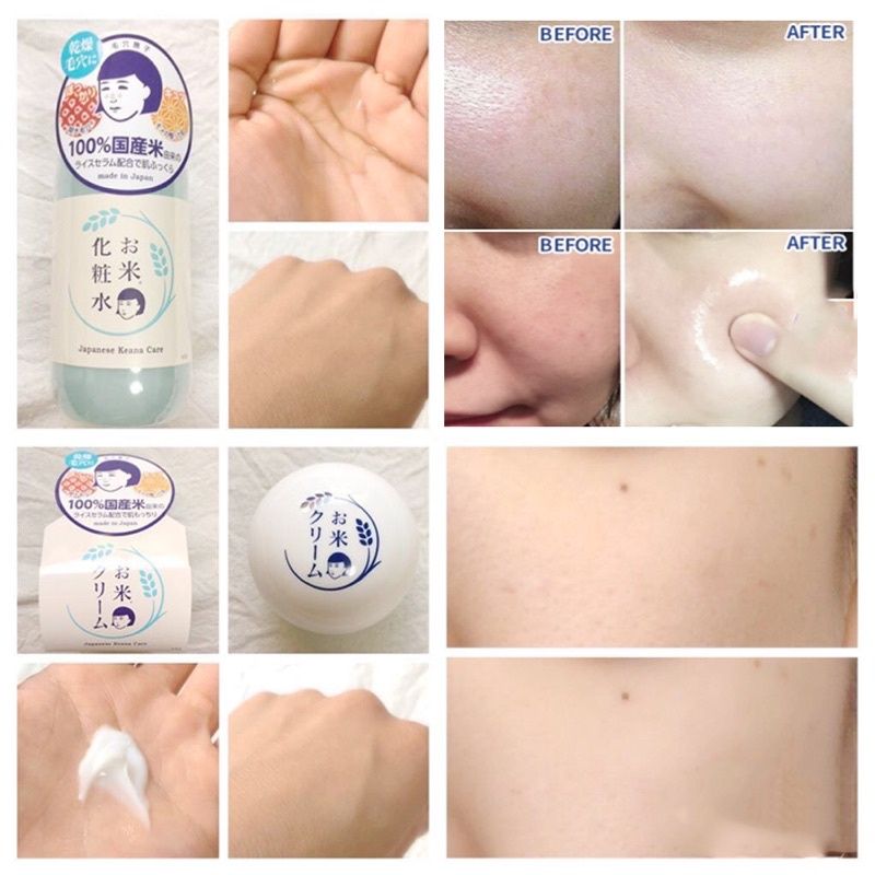 Bộ Dưỡng Trắng, Cấp Ẩm, Ngừa Mụn Keana Nhật Bản Chiết Xuất Cám Gạo, Se Khít Lỗ Chân Lông, Làm Mờ Vết Thâm