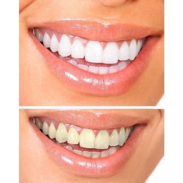 Kem Đánh Răng Aquafresh  Nhật Bản Giúp Trắng Răng, Hơi Thở Thơm Mát, Ngừa Sâu Răng, Nướu Chắc Khoẻ 160G