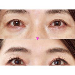 Kem Dưỡng Da Vùng Mắt Toami Wrinkless White Eye Cream 15G