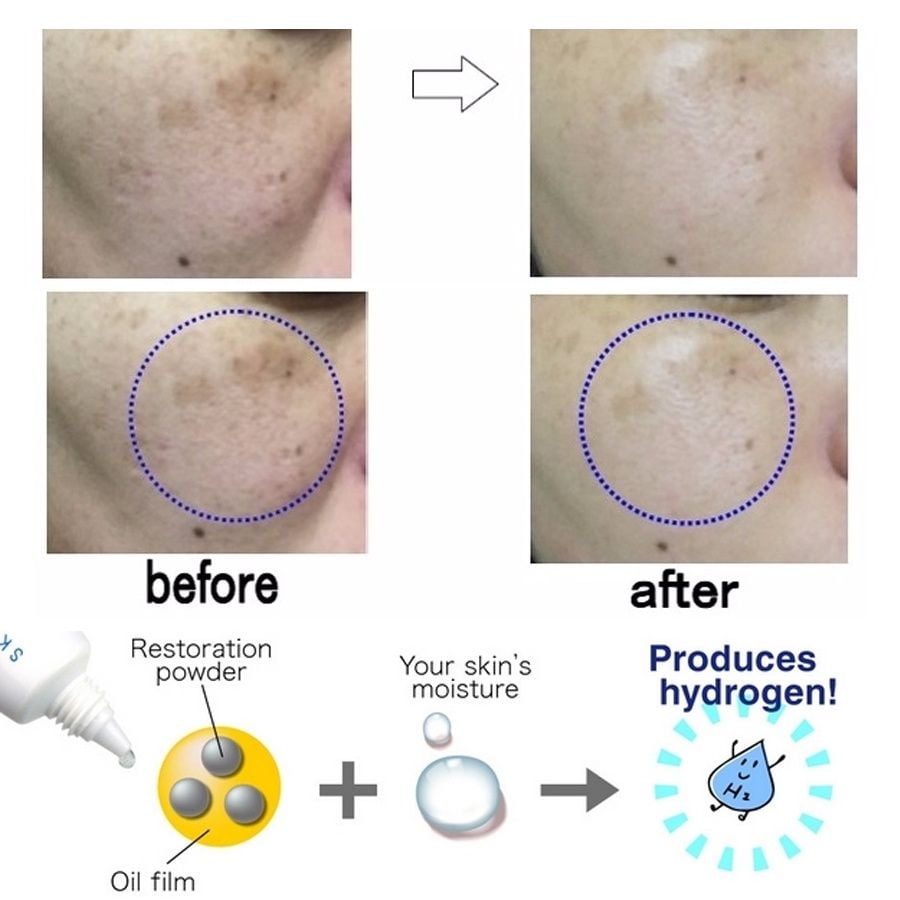 Kem Giảm Nám H2 Hydrogen Skin Spot Cream Nhật Bản Loại Bỏ Nám, Tàn Nhang, Đồi Mồi Từ Sâu Bên Trong Da 10 Gram