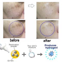Kem Giảm Nám H2 Hydrogen Skin Spot Cream Nhật Bản Loại Bỏ Nám, Tàn Nhang, Đồi Mồi Từ Sâu Bên Trong Da 10 Gram