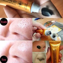 Gel Lột Mụn Đầu Đen Kose Softymo Cleansing Gel Nhật Bản 25g