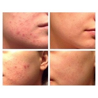 Kem PG Collagen Sụn Cá Morepas Care EX Phiên Bản Mới Cải Tiến Với Nhiều Dưỡng Chất - 80g