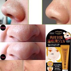 Gel Lột Mụn Đầu Đen Kose Softymo Cleansing Gel Nhật Bản 25g