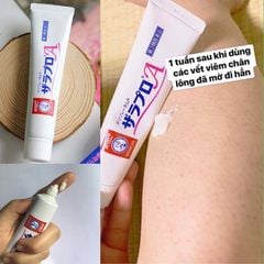 Kem Trị Viêm Nang Lông Zaraporo Rohto Nhật Bản 35g
