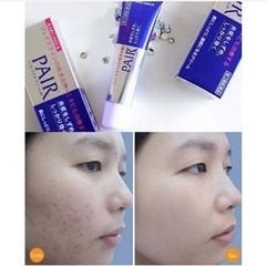 Kem ngừa mụn Pair Acne W Cream Nhật Bản giúp giảm sạch mụn 24g
