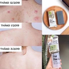 Bộ Xà Phòng Sạch Mụ.n Lưng Forback PELICAN Nhật Bản