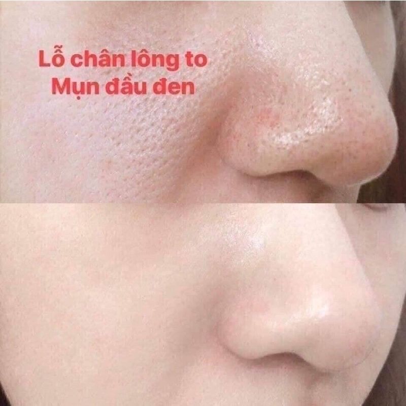 Kem Se Khít Lỗ Chân Lông Thu nhỏ lỗ chân lông, ngừa tiết dầu, trắng trong SQS Nhật Bản 15 ML