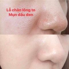 Kem Se Khít Lỗ Chân Lông Thu nhỏ lỗ chân lông, ngừa tiết dầu, trắng trong SQS Nhật Bản 15 ML