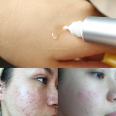 Tinh Chất Dưỡng Trắng Da Chống Thâm Nám Melano CC Whitening Essence 20ml