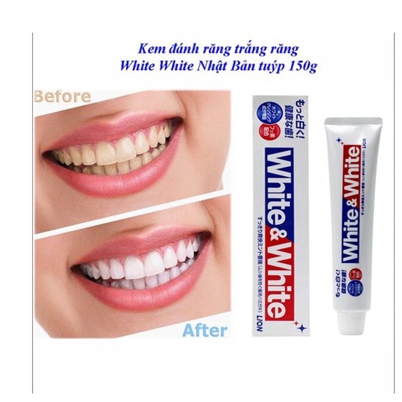 Kem Đánh Răng White & White Lion Nhật Bản, Giúp Làm Trắng Trăng, Hơi Thở Thơm Mát, Chắc Khoẻ, Ngừa Sâu Răng 150G