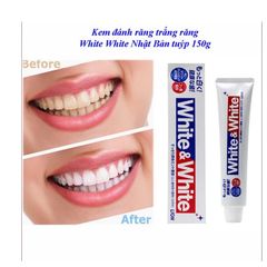 Kem Đánh Răng White & White Lion Nhật Bản, Giúp Làm Trắng Trăng, Hơi Thở Thơm Mát, Chắc Khoẻ, Ngừa Sâu Răng 150G