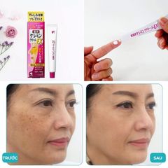 [Kem Giảm Thâm Mờ Nám, Tàn Nhang] Kobayashi EX Keshimin Nhật Bản 12G