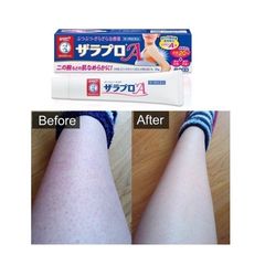 Kem Trị Viêm Nang Lông Zaraporo Rohto Nhật Bản 35g