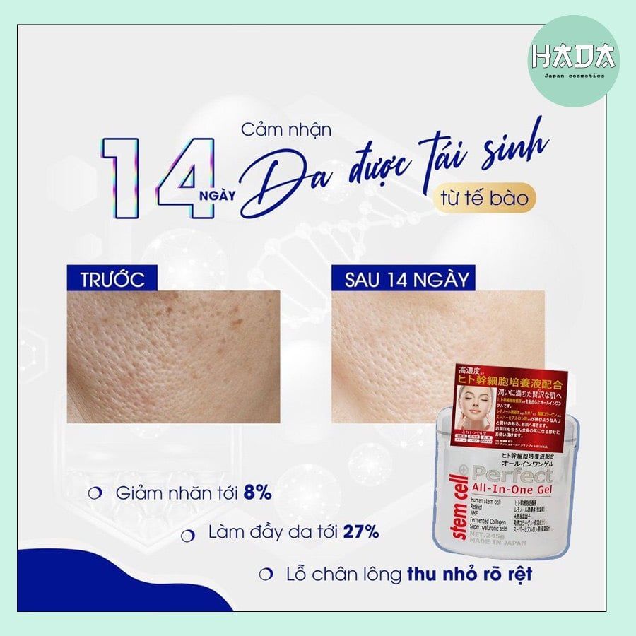 Gel Dưỡng Trắng Da NMN Nhật Bản 245G - Gel Chống Lão Hóa