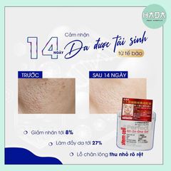 Gel Dưỡng Trắng Da NMN Nhật Bản 245G - Gel Chống Lão Hóa
