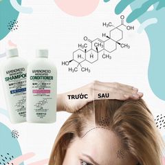 Bộ Dầu Gội Xả Kaminomoto Ngăn Ngừa Rụng Tóc, Kích Thích Mọc Tóc, Hỗ Trợ Phục Hồi Tóc Hư Tổn Nhật Bản 300ml