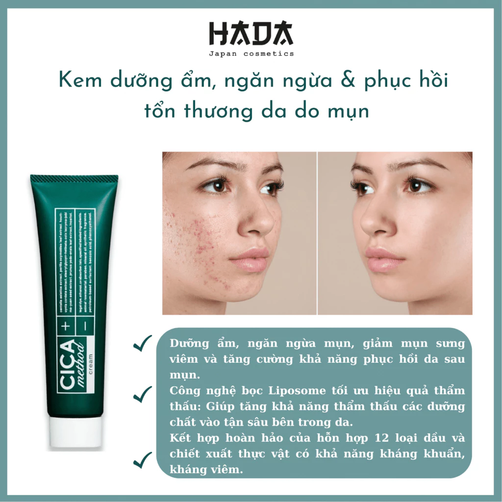 Combo chăm sóc toàn diện cho da mụn Cica Method (Kem dưỡng, tinh chất và xịt phun sương)