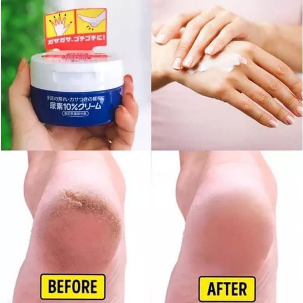 Kem trị nứt nẻ gót chân, tay Shiseido Urea Cream Nhật 100g