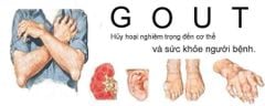 Viên Uống Hỗ Trợ Điều Trị Bệnh Gout Anserine Minami Nhật Bản 240 viên