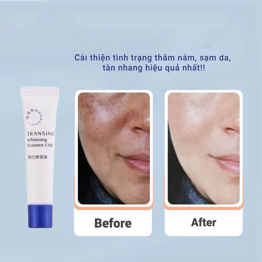 Set Dưỡng Transino Giảm Nam Trắng Da 3 Món Mini Nhật Bản