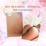  Xà phòng ngừa thâm mông và làm sạch cơ thể từ quả đào Pelican Hip Care Soap - Nhật Bản 