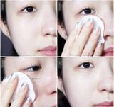  Nước hoa hồng dưỡng sáng da, trị nám Dongsung Rannce Skin 130ml 
