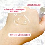  Siêu Tinh Chất Xoá Thâm, Mờ Nám Da Angel's Liquid Tranexamic Mela Ampoule 30ml 