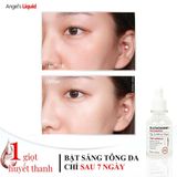  Tinh chất dưỡng trắng, trị nám Angel’s Liquid 7 Day Whitening Program Glutathione + Niacinamide 700V Ampoule 30ml 