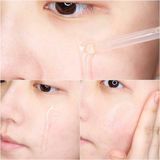  Tinh Chất Phục Hồi Da, Dưỡng ẩm Tinh Chất Phục Hồi Da, Dưỡng ẩm Goodndoc Hydra B5 Serum 30ml 