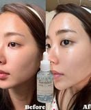  [HOT] Tinh Chất Siêu Cấp ẩm, Phục Hồi Da Torriden DIVE IN Serum 50ml 