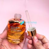  Tinh Chất trị mụn Derladie Witch Hazel Perfect Vitamin Serum 35ml 