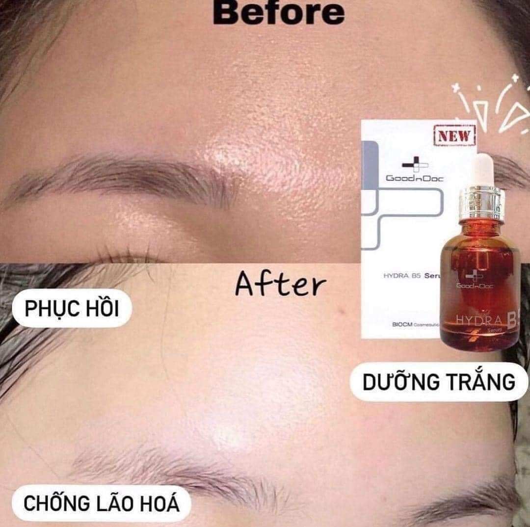  Tinh Chất Phục Hồi Da, Dưỡng ẩm Tinh Chất Phục Hồi Da, Dưỡng ẩm Goodndoc Hydra B5 Serum 30ml 