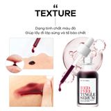  Tinh Chất Tẩy Da Chết Hóa Học So’Natural Red Peel Tingle Serum 35ML 