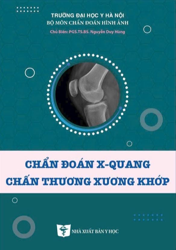 Chẩn Đoán X-Quang Chấn Thương Xương Khớp - ĐH Y Hà Nội