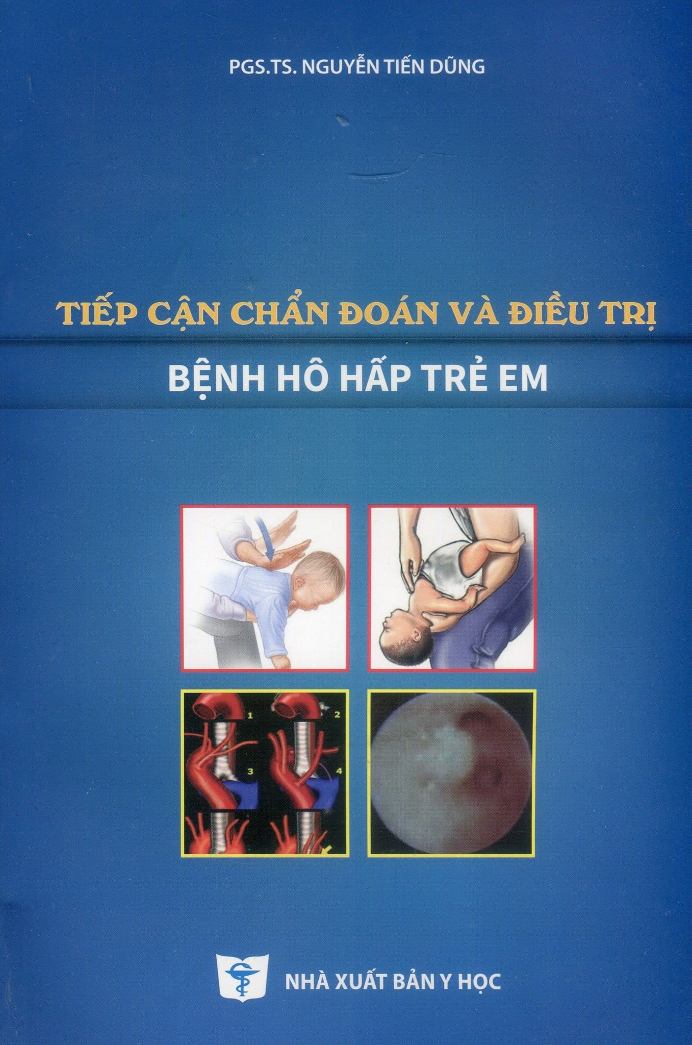 Tiếp Cận Chẩn Đoán Và Điều Trị Bệnh Hô Hấp Trẻ Em - PGS.TS. Nguyễn Tiến Dũng