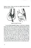  Phẫu Thuật Nội Soi Khớp Gối - PGS.TS.Nguyễn Xuân Thùy 
