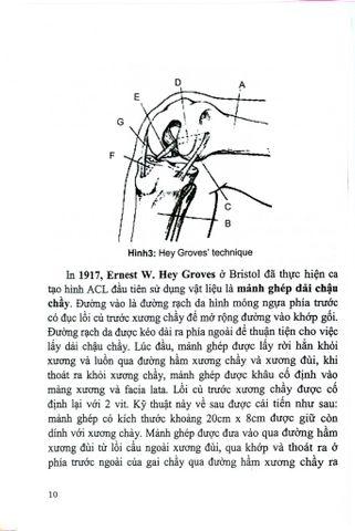  Phẫu Thuật Nội Soi Khớp Gối - PGS.TS.Nguyễn Xuân Thùy 