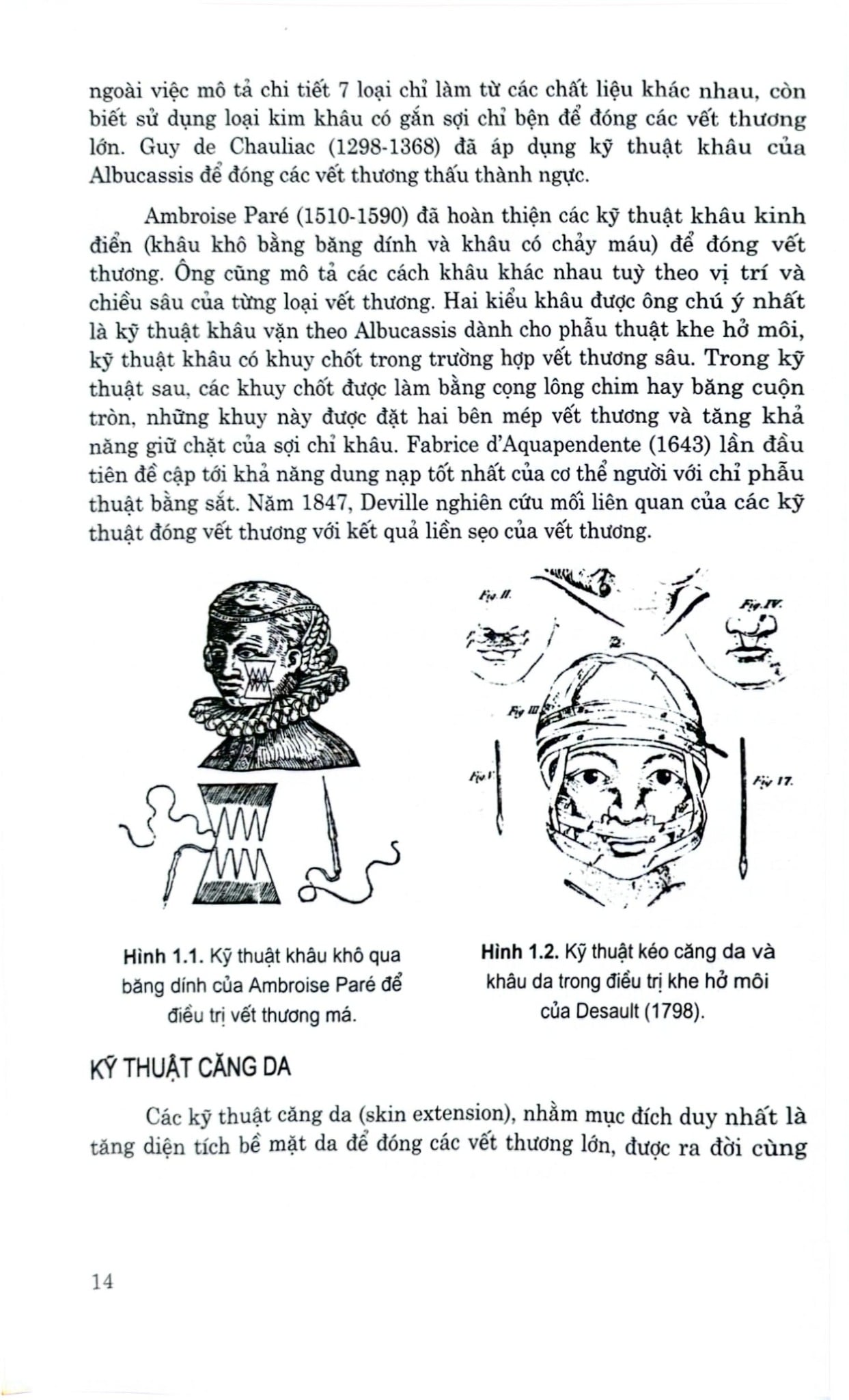 Phương Pháp Giãn Da Trong Phẫu Thuật Tạo Hình Và Thẩm Mỹ  - GS.TS. Trần Thiết Sơn - PGS.TS. Nguyễn Bắc Hùng