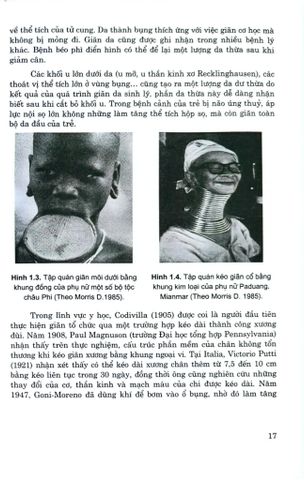  Phương Pháp Giãn Da Trong Phẫu Thuật Tạo Hình Và Thẩm Mỹ  - GS.TS. Trần Thiết Sơn - PGS.TS. Nguyễn Bắc Hùng 