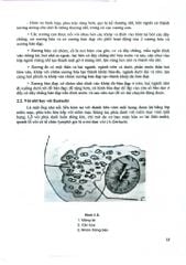 Bệnh Học Tai- Mũi- Họng Đầu Mặt Cổ - GS.TS. Ngô Ngọc Liễn