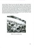  Chấn Thương Chỉnh Hình - PGS. Nguyễn Đức Phúc 