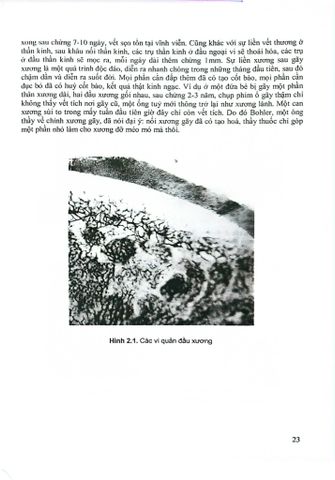  Chấn Thương Chỉnh Hình - PGS. Nguyễn Đức Phúc 