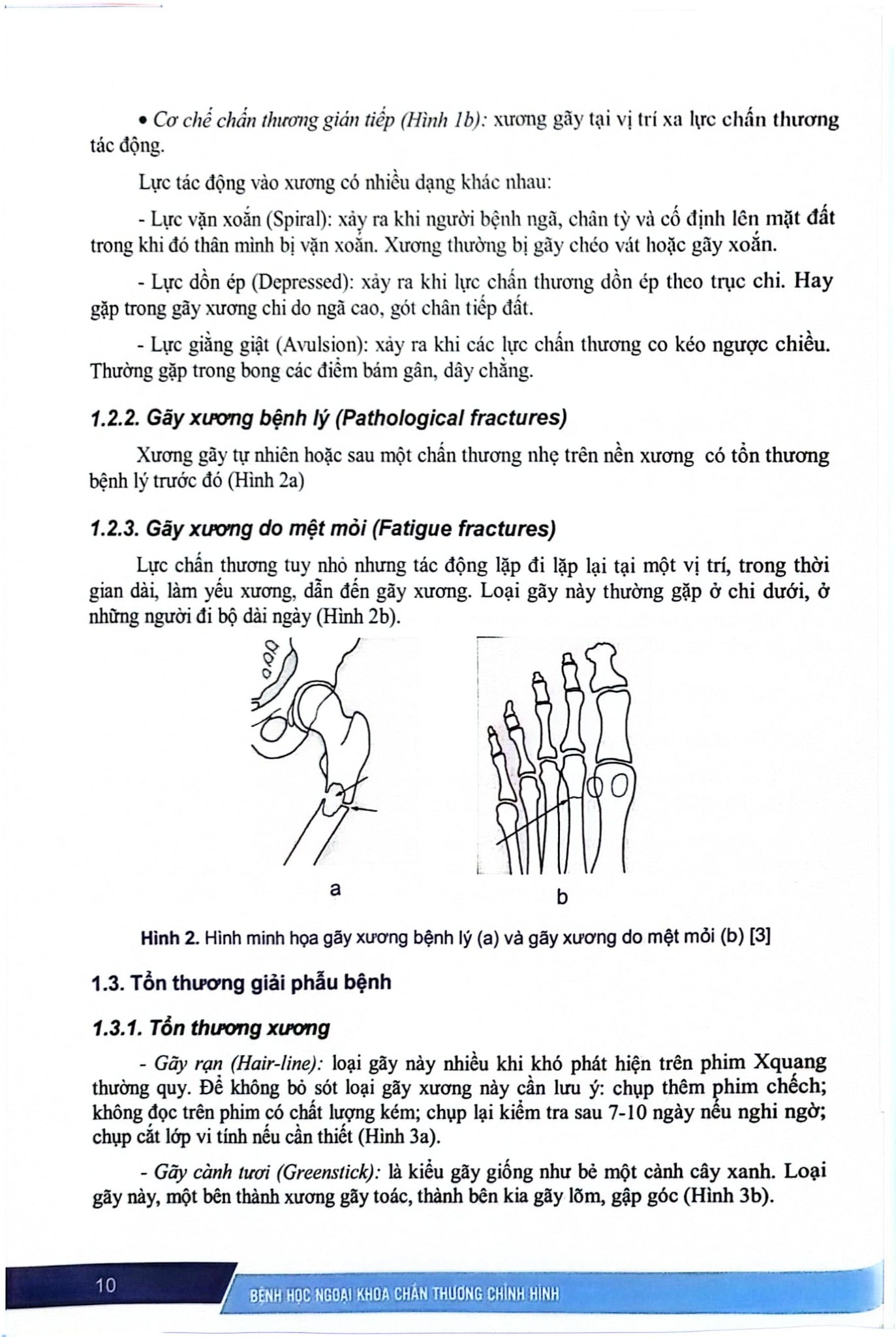 Bệnh Học Ngoại Khoa Chấn Thương Chỉnh Hình (SĐH) - ĐH Y Hà Nội, PGS.TS. Đoàn Quốc Hưng, GS.TS. Trần Trung Dũng