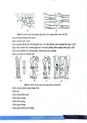 Bệnh Học Ngoại Khoa Chấn Thương Chỉnh Hình (SĐH) - ĐH Y Hà Nội, PGS.TS. Đoàn Quốc Hưng, GS.TS. Trần Trung Dũng