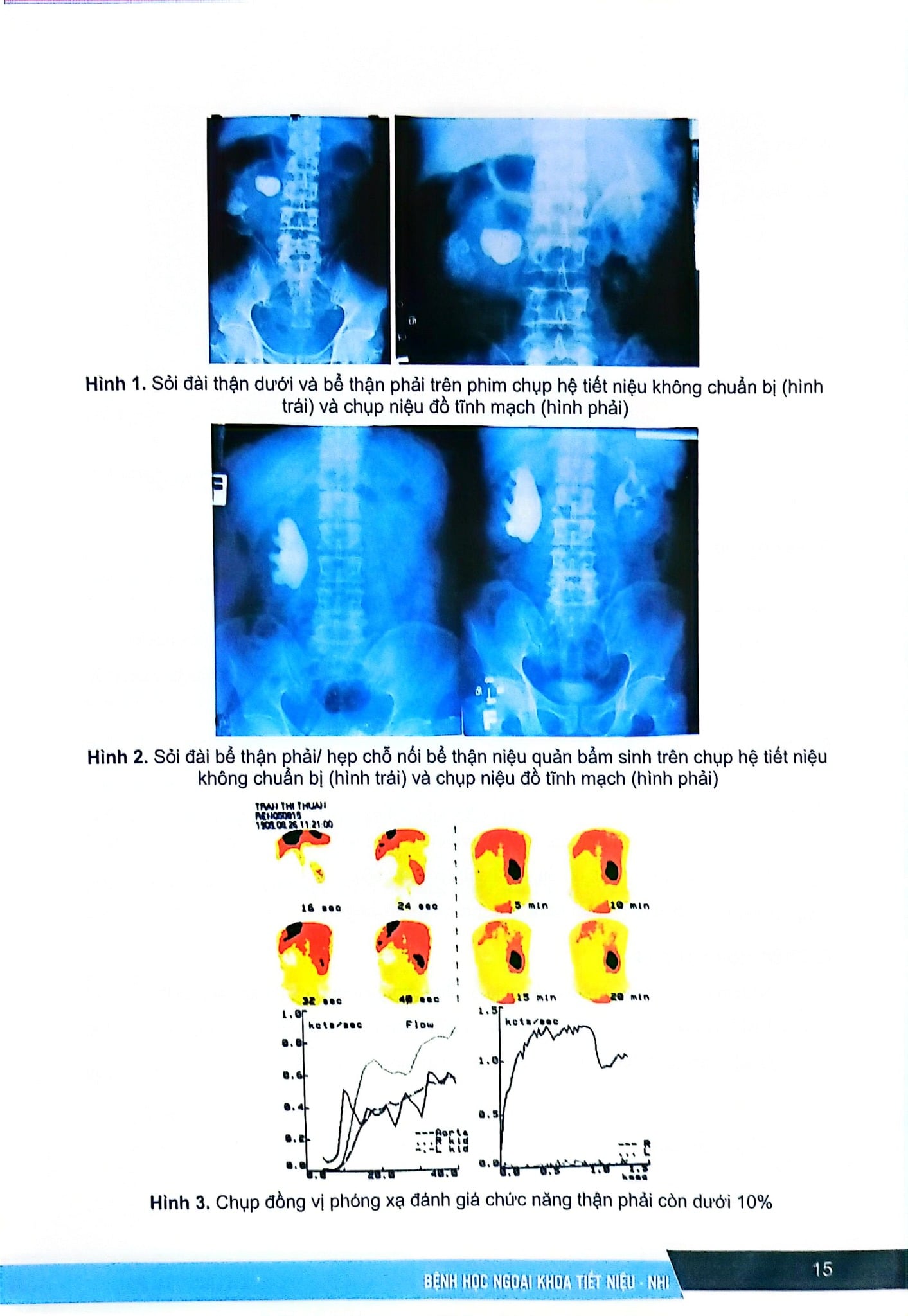 Bệnh Học Ngoại Khoa Tiết Niệu Nhi (Dùng Cho Đào Tạo Sau Đại Học) - ĐH Y Hà Nội