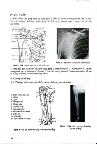  Giải Phẫu X - Quang Sách Đào Tạo Cử Nhận Kỹ Thuật Y Học (Chuyên Ngành Kỹ Thuật Hình Ảnh) - Bộ Y tế, Nguyễn Doãn Cường 
