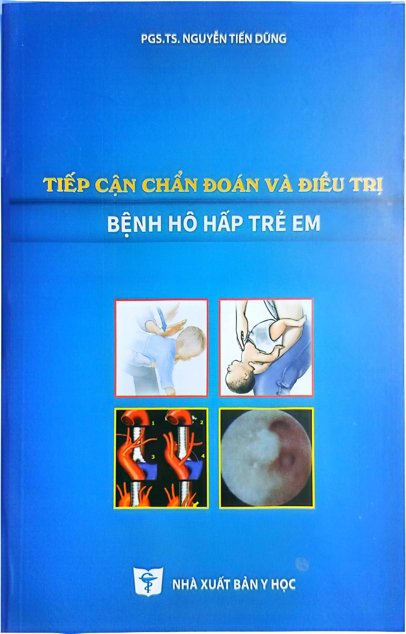 Tiếp Cận Chẩn Đoán Và Điều Trị Bệnh Hô Hấp Trẻ Em - PGS.TS. Nguyễn Tiến Dũng